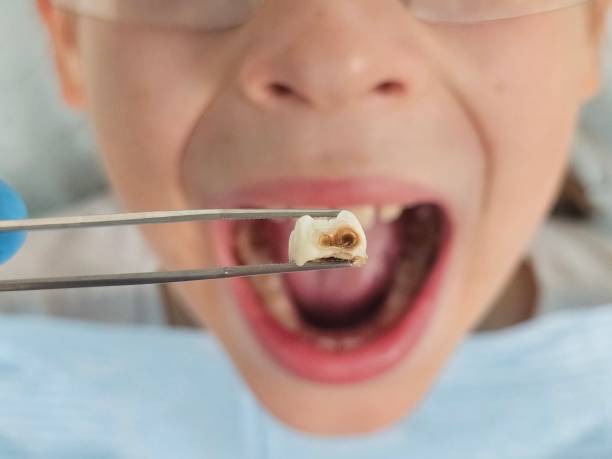 Best Tooth Infection Emergency Dentist  in Prosper, TX